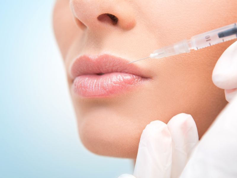 asimetria labios con acido hialuronico