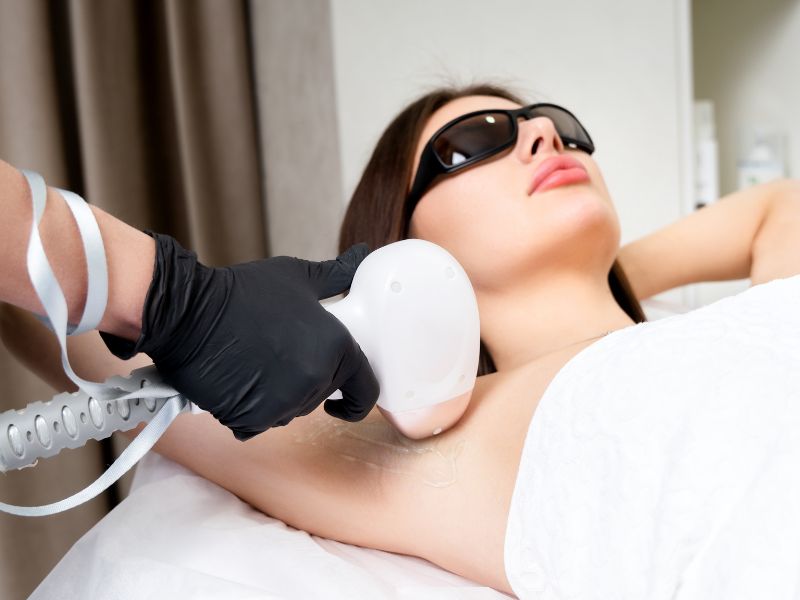 ventajas de la depilación láser