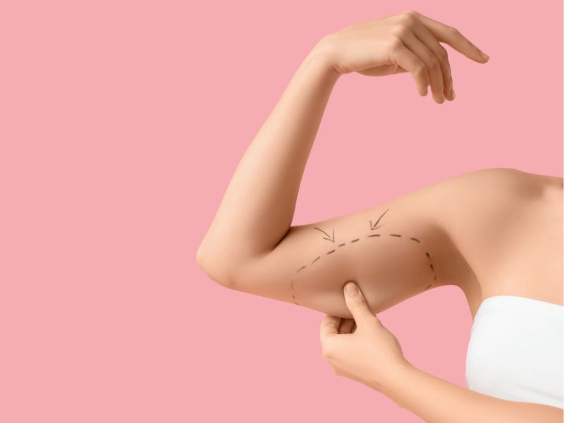 diferencias entre mesoterapia y lipolisis